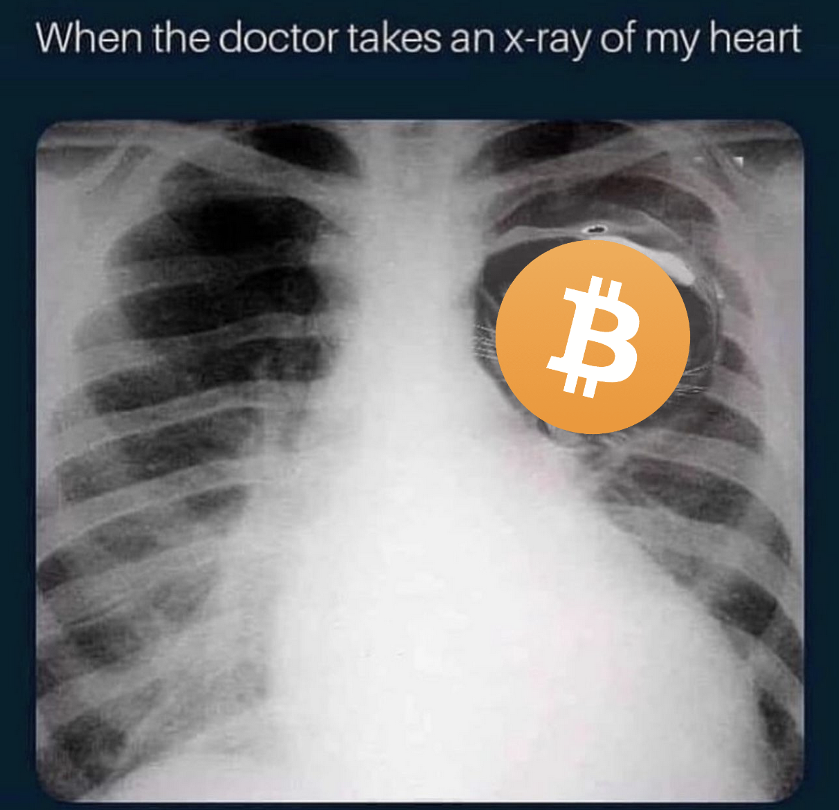 When the doctor takes an x-ray of my heart